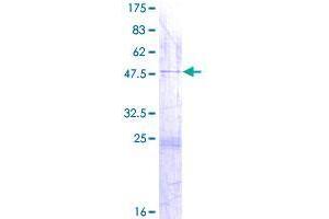 Image no. 1 for Dual Specificity Phosphatase 26 (DUSP26) (AA 1-211) protein (GST tag) (ABIN1352127) (DUSP26 Protein (AA 1-211) (GST tag))