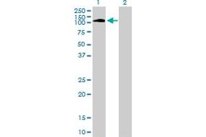 Western Blot analysis of PTK2B expression in transfected 293T cell line by PTK2B monoclonal antibody (M01), clone 1F9. (PTK2B antibody  (AA 682-871))