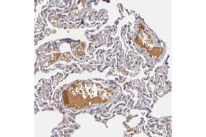 Immunohistochemical staining of human lung with LRG1 polyclonal antibody  shows distinct positivity in plasma. (LRG1 antibody)