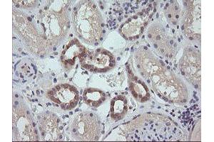 Image no. 1 for anti-RAB21, Member RAS Oncogene Family (RAB21) antibody (ABIN1500541) (RAB21 antibody)