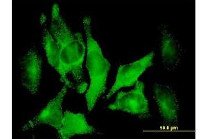 Immunofluorescence of purified MaxPab antibody to DAB2 on HeLa cell. (DAB2 antibody  (AA 1-770))