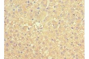 Immunohistochemistry of paraffin-embedded human liver tissue using ABIN7169536 at dilution of 1:100 (ACADS antibody  (AA 1-260))