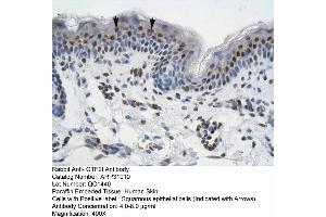 Rabbit Anti-GTF21 Antibody  Paraffin Embedded Tissue: Human Skin Cellular Data: Squamous epithelial cells Antibody Concentration: 4.