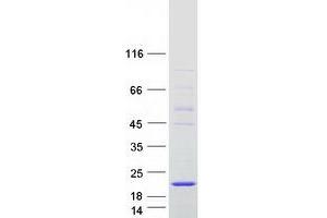 Validation with Western Blot