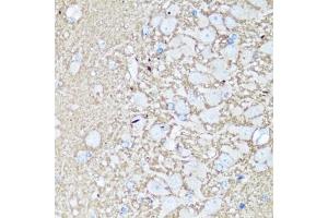 Immunohistochemistry of paraffin-embedded rat brain using V antibody (ABIN3021846, ABIN3021847, ABIN1513674 and ABIN6216136) at dilution of 1:100 (40x lens). (VAMP2 antibody  (AA 1-100))