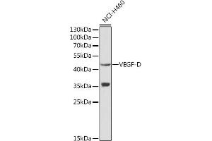 Western blot analysis of extracts of NCI-H460 cells, using VEGFD antibody (ABIN3021685, ABIN3021686, ABIN3021687 and ABIN6215506) at 1:1000 dilution. (VEGFD antibody  (AA 20-220))