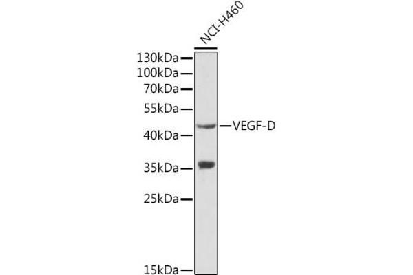 VEGFD Antikörper  (AA 20-220)