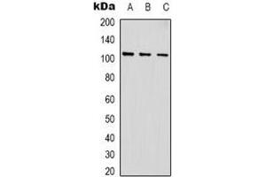 Western blot analysis of ACTN1 expression in NIH3T3 (A), PC12 (B), rat heart (C) whole cell lysates. (ACTN1 antibody)