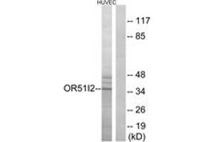 Western blot analysis of extracts from HuvEc cells, using OR51I2 Antibody. (OR51I2 antibody  (AA 201-250))