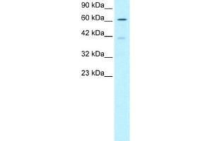WB Suggested Anti-SKIIP Antibody Titration:  0.