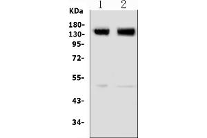 Western blot analysis of GRM5 using anti-GRM5 antibody (ABIN7600849).
