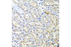 Immunohistochemistry of paraffin-embedded rat kidney using LRP2 antibody (ABIN5995557) at dilution of 1/100 (40x lens). (LRP2 antibody)