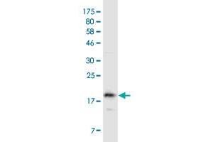Western Blot detection against Immunogen (20. (TACI antibody  (AA 2-165))