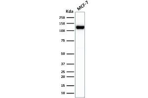 Western Blotting (WB) image for anti-Cadherin 1, Type 1, E-Cadherin (Epithelial) (CDH1) antibody (ABIN6941298)
