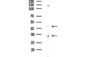 anti-Septin 2 (SEPT2) (Internal Region) antibody