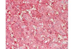 Human Liver: Formalin-Fixed, Paraffin-Embedded (FFPE) (Albumin antibody)