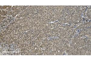 IHC analysis of U2AF65/U2AF2 using anti U2AF65/U2AF2 antibody (ABIN7600794). (U2AF2 antibody  (AA 238-470))