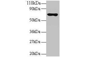 Western blot All lanes: RPL15 antibody at 2 μg/mL + 293T whole cell lysate Secondary Goat polyclonal to rabbit IgG at 1/15000 dilution Predicted band size: 25, 17 kDa Observed band size: 70 kDa (RPL15 antibody  (AA 2-204))