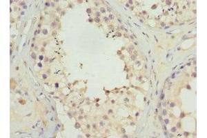 Immunohistochemistry of paraffin-embedded human testis tissue using ABIN7174649 at dilution of 1:100 (UGT3A2 antibody  (AA 23-300))