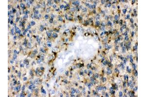 Anti- Eph receptor B1 Picoband antibody, IHC(P) IHC(P): Human Glioma Tissue (EPH Receptor B1 antibody  (N-Term))