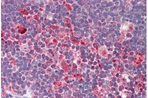 Human Thymus (formalin-fixed, paraffin-embedded) stained with IL32 antibody ABIN214502 at 2. (IL32 antibody  (C-Term))
