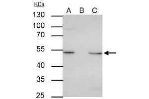IP Image ILK antibody [N1C1] immunoprecipitates ILK protein in IP experiments. (ILK antibody)