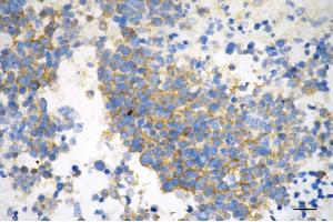 anti-phosphoglycerate Dehydrogenase (PHGDH) antibody