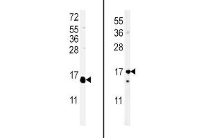 (LEFT)Western blot analysis of IL4 Antibody (C-term) (ABIN651434 and ABIN2840238) in WiDr cell line lysates (35 μg/lane). (IL-4 antibody  (C-Term))