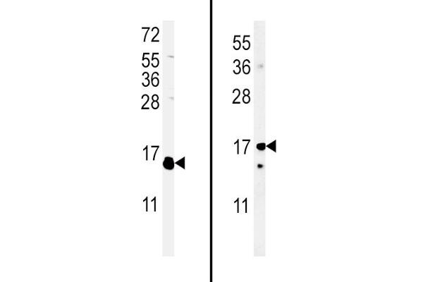 IL-4 antibody  (C-Term)