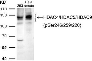 Western blot analysis of extracts from 293 cells and Hela cells treated with serum using HDAC4/HDAC5/HDAC9 (phospho-Ser246/259/220) Antibody.