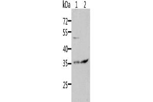 Western Blotting (WB) image for anti-Suppressor of Cytokine Signaling 1 (SOCS1) antibody (ABIN2431838) (SOCS1 antibody)