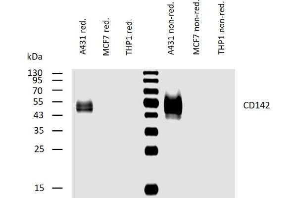 Tissue factor antibody