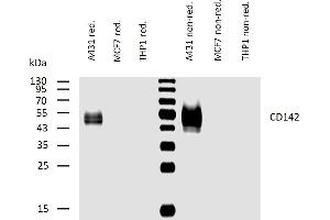 Western blotting analysis of human CD142 using mouse monoclonal antibody HTF-1 on lysates of A431 cell line and MCF7 and THP1 cell lines (negative controls) under reducing and non-reducing conditions.