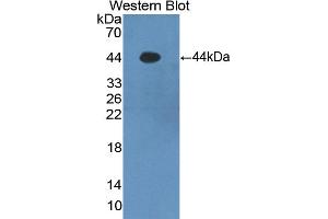 Detection of recombinant S100A7 using Polyclonal Antibody to S100 Calcium Binding Protein A7 (S100A7) (S100A7 antibody  (AA 1-101))