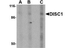 Western blot analysis of DISC1 in SK-N-SH cell lysate with AP30292PU-N DISC1 antibody at (A) 0. (DISC1 antibody  (Center))