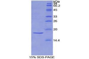 SDS-PAGE (SDS) image for Sema Domain, Immunoglobulin Domain (Ig), Short Basic Domain, Secreted, (Semaphorin) 3A (SEMA3A) (AA 31-150) protein (His tag) (ABIN2126722)