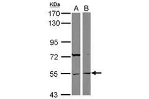 Image no. 1 for anti-Ankyrin Repeat and SOCS Box-Containing 3 (ASB3) (AA 197-433) antibody (ABIN1496739) (ASB3 antibody  (AA 197-433))