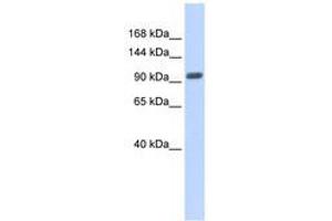 Image no. 1 for anti-Zinc Finger Protein 512B (ZNF512B) (AA 539-588) antibody (ABIN6740330)