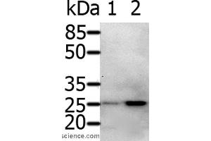 Western blot analysis of 231 cell and Human fetal brain tissue, using RAB5A Polyclonal Antibody at dilution of 1:600 (RAB5 antibody)