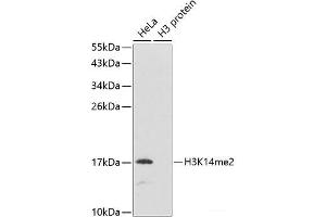 Western blot analysis of extracts of various cell lines using DiMethyl-Histone H3-K14 Polyclonal Antibody. (Histone 3 antibody  (2meLys14))