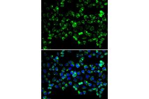 Immunofluorescence analysis of HeLa cells using PINK1 antibody (ABIN5998524). (PINK1 antibody)