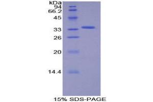 SDS-PAGE (SDS) image for Salt-Inducible Kinase 2 (SIK2) (AA 655-925) protein (His tag) (ABIN2126703)