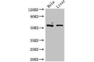 Western Blot Positive WB detected in: Hela whole cell lysate, Mouse liver tissue All lanes: KRT81 antibody at 5 μg/mL Secondary Goat polyclonal to rabbit IgG at 1/50000 dilution Predicted band size: 55 kDa Observed band size: 55 kDa (KRT81 antibody  (AA 3-505))