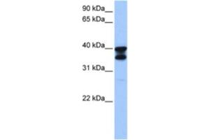 Western Blotting (WB) image for anti-Solute Carrier Family 25 (Mitochondrial Carrier, Adenine Nucleotide Translocator), Member 31 (SLC25A31) antibody (ABIN2463612) (SLC25A31 antibody)