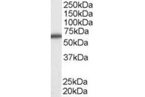 Western Blotting (WB) image for anti-DEAD (Asp-Glu-Ala-Asp) Box Polypeptide 5 (DDX5) (C-Term) antibody (ABIN2465593) (DDX5 antibody  (C-Term))