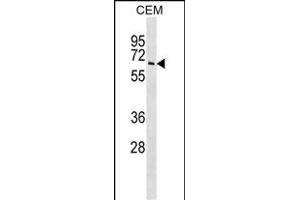 T Antibody (N-term) (ABIN1539423 and ABIN2848697) western blot analysis in CEM cell line lysates (35 μg/lane). (TPP1 antibody  (N-Term))