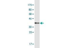 Western Blot detection against Immunogen (36. (NPHP3 antibody  (AA 106-205))