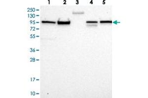 Western blot analysis of Lane 1: RT-4, Lane 2: U-251 MG, Lane 3: Human Plasma, Lane 4: Liver, Lane 5: Tonsil with FCHSD2 polyclonal antibody  at 1:250-1:500 dilution.