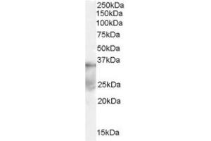 Image no. 1 for anti-Deleted in Azoospermia-Like (DAZL) (Internal Region) antibody (ABIN374590) (DAZL antibody  (Internal Region))