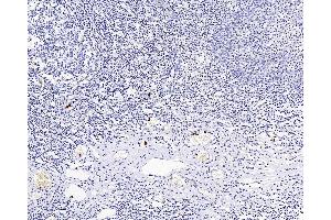 Immunohistochemistry analysis of paraffin-embedded Human amygdalitis using ITGAX Polyclonal Antibody at dilution of 1:200. (CD11c antibody)
